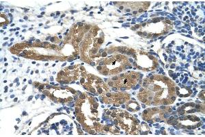 Immunohistochemistry (IHC) image for anti-Histone Deacetylase 9 (HDAC9) (C-Term) antibody (ABIN2775576)