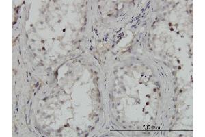 Immunoperoxidase of monoclonal antibody to CHUK on formalin-fixed paraffin-embedded human testis. (IKK alpha antibody  (AA 646-745))