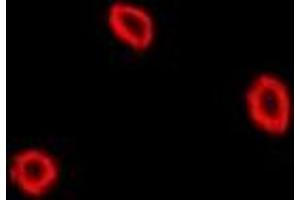 Immunofluorescent analysis of NPC2 staining in U2OS cells. (NPC2 antibody)