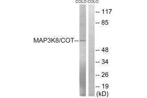 Western blot analysis of extracts from COLO cells, treated with Insulin (0. (MAP3K8 antibody  (Ser400))