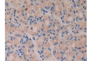 Detection of AZU in Human Stomach Tissue using Polyclonal Antibody to Azurocidin (AZU) (Azurocidin antibody  (AA 23-247))