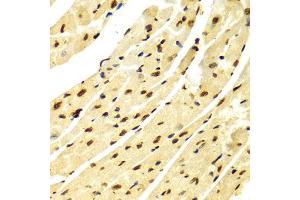 Immunohistochemistry of paraffin-embedded Mouse heart using DiMethyl-Histone H3-K79 antibody (ABIN1873007) at dilution of 1:100 (40x lens).