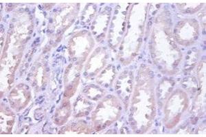 Immunohistochemistry of paraffin-embedded human kidney tissue using ABIN7173839 at dilution of 1:100 (TNFRSF1D (AA 58-208) antibody)