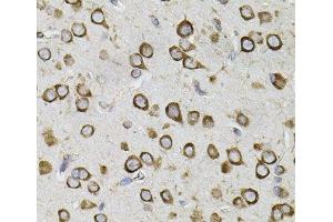 Immunohistochemistry of paraffin-embedded Mouse brain using CEP164 Polyclonal Antibody (CEP164 antibody)