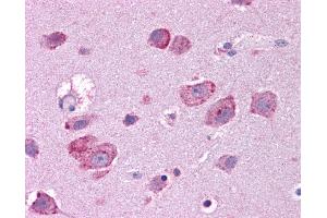 HGF antibody was used for immunohistochemistry at a concentration of 4-8 ug/ml. (HGF antibody)