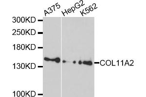 Western blot analysis of extracts of various cell lines, using COL11A2 antibody. (COL11A2 antibody)