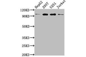 Western Blot Positive WB detected in: HepG2 whole cell lysate, 293T whole cell lysate, U251 whole cell lysate, Jurkat whole cell lysate All lanes: KPNB1 antibody at 1:2000 Secondary Goat polyclonal to rabbit IgG at 1/50000 dilution Predicted band size: 98, 82 kDa Observed band size: 98 kDa (KPNB1 antibody  (AA 9-214))