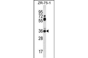 Western blot analysis in ZR-75-1 cell line lysates (35ug/lane). (STX2 antibody  (AA 123-152))