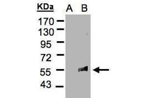 WB Image Western Blot analysis of FLVCR1 expression in transfected 293T cell line by FLVCR1 polyclonal antibody. (FLVCR antibody  (C-Term))