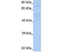 WB Suggested Anti-JPH3 Antibody Titration:  1. (Junctophilin 3 antibody  (N-Term))