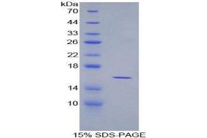 SDS-PAGE (SDS) image for Osteoglycin (OGN) (AA 180-298) protein (His tag) (ABIN1171078) (OGN Protein (AA 180-298) (His tag))