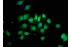 Immunofluorescence staining of A549 cells with ABIN7174107 at 1:200, counter-stained with DAPI. (PTPN3 antibody  (AA 365-505))