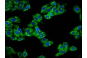 Immunofluorescence staining of HepG2 cells with ABIN7154588 at 1:133, counter-stained with DAPI. (REM1 antibody  (AA 2-153))