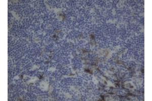 Image no. 2 for anti-Coagulation Factor XIII, A1 Polypeptide (F13A1) antibody (ABIN1498151)