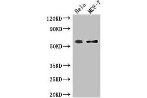 Western Blot Positive WB detected in: Hela whole cell lysate, MCF-7 whole cell lysate All lanes: PUF60 antibody at 2. (Pumilio Homolog 3 (PUM3) (AA 302-413) antibody)