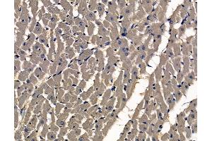 ABIN7097001 and ABIN7101068 at 1/100 staining rat heart tissue by IHC-P. (SASS6 antibody)
