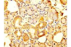 IHC image of ABIN7170071 diluted at 1:300 and staining in paraffin-embedded human salivary gland tissue performed on a Leica BondTM system. (SLC12A2 antibody  (AA 110-282))