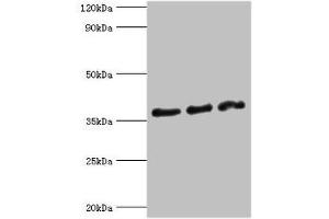 Western blot All lanes: DFFA antibody at 10 μg/mL Lane 1: Hela whole cell lysate Lane 2: 293T whole cell lysate Lane 3: PC-3 whole cell lysate Secondary Goat polyclonal to rabbit IgG at 1/10000 dilution Predicted band size: 37, 30 kDa Observed band size: 37 kDa (DFFA antibody  (AA 1-331))