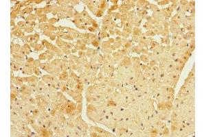 Immunohistochemistry of paraffin-embedded human heart tissue using ABIN7152437 at dilution of 1:100 (FBXO4 antibody  (AA 138-387))