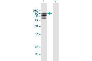 Western Blot analysis of PDGFRA expression in transfected 293T cell line by PDGFRA MaxPab polyclonal antibody.