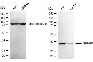 Western blotting analysis using GRHPR antibody (ABIN7798787).