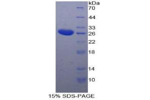 SDS-PAGE analysis of Human TPPP Protein.