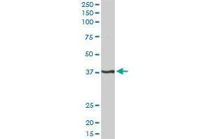 PITX1 MaxPab rabbit polyclonal antibody. (PITX1 antibody  (AA 1-314))
