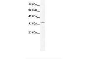Image no. 1 for anti-Zinc Finger Protein 589 (ZNF589) (AA 185-234) antibody (ABIN203078)