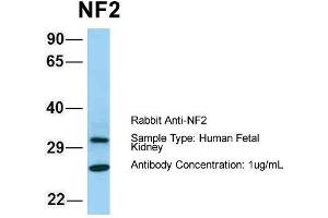 Host: Rabbit  Target Name: NF2  Sample Tissue: Human Fetal Kidney  Antibody Dilution: 1. (Merlin antibody  (C-Term))
