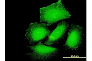 Immunofluorescence of purified MaxPab antibody to PPP1R3B on HeLa cell. (PPP1R3B antibody  (AA 1-285))