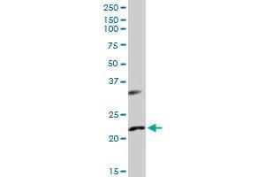 AK1 MaxPab rabbit polyclonal antibody. (Adenylate Kinase 1 antibody  (AA 1-194))