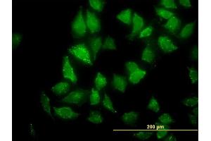 Immunofluorescence of monoclonal antibody to CNO on HeLa cell.