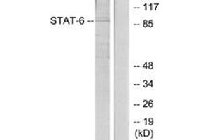 Western blot analysis of extracts from HeLa cells, using STAT6 (Ab-645) Antibody.