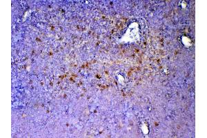 Immunohistochemistry (IHC) image for anti-Inducible T-Cell Co-Stimulator (ICOS) (AA 21-200) antibody (ABIN5693001)