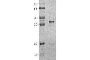 Validation with Western Blot (GFAP Protein (His tag))