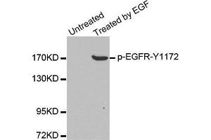 Western blot analysis of extracts from A431 cells, using Phospho-EGFR-Y1172 antibody. (EGFR antibody  (pTyr1172))