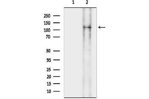 anti-Lemur Tyrosine Kinase 3 (LMTK3) antibody