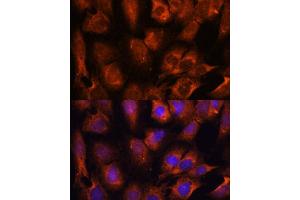 Immunofluorescence analysis of C6 cells using INPP5E antibody (ABIN7267883) at dilution of 1:100. (INPP5E antibody  (AA 510-630))