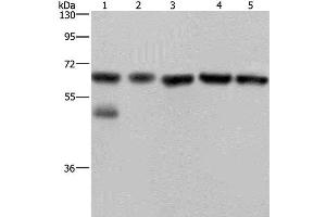 Western Blot analysis of Jurkat cell and Human brain malignant glioma tissue, PC3, K562 and A549 cell using NUP62 Polyclonal Antibody at dilution of 1:300 (NUP62 antibody)