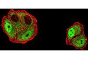 Immunofluorescence analysis of Hela cells using DDX1 mouse mAb (green). (DDX1 antibody  (AA 642-740))
