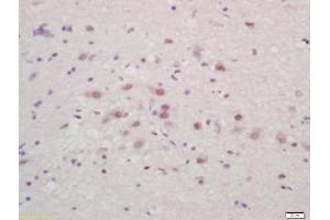 Formalin-fixed and paraffin embedded mouse brain labeled with Anti-ZNF231 Polyclonal Antibody, Unconjugated (ABIN727145) at 1:200 followed by conjugation to the secondary antibody and DAB staining (Bassoon antibody  (AA 2901-3000))