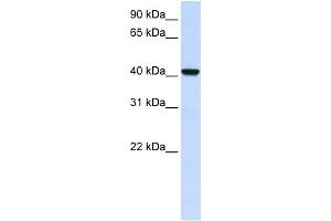 WB Suggested Anti-DGAT2L4 Antibody Titration:  0. (AWAT2 antibody  (C-Term))