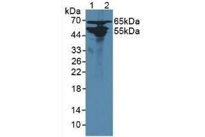 Figure. (AGXT2 antibody  (AA 225-512))