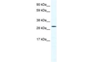 Western Blotting (WB) image for anti-SRY (Sex Determining Region Y)-Box 12 (SOX12) antibody (ABIN2460695)