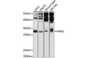 Western blot analysis of extracts of various cell lines, using EMG1 antibody (ABIN1875902) at 1:1000 dilution. (EMG1 antibody)