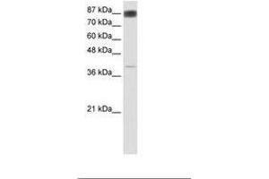 Image no. 1 for anti-Nuclear Factor of Activated T-Cells, Cytoplasmic, Calcineurin-Dependent 4 (NFATC4) (AA 241-290) antibody (ABIN6736168) (NFATC4 antibody  (AA 241-290))