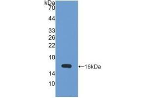 Detection of Recombinant UBE1L, Human using Polyclonal Antibody to Ubiquitin Activating Enzyme E1 Like Protein (UBE1L) (ATG7 antibody  (AA 429-488))