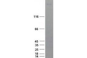 Validation with Western Blot (LMTK3 Protein (Myc-DYKDDDDK Tag))