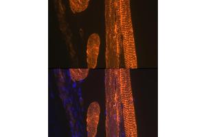 Immunofluorescence analysis of rat skeletal muscle using α-Actin-1  Rabbit mAb (ABIN1682816, ABIN7101454, ABIN7101455 and ABIN7101456) at dilution of 1:100 (40x lens).
