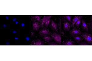 Immunocytochemical staining of H9C2 cells with RAB22A antibody (ABIN7800090), 1:1,000).